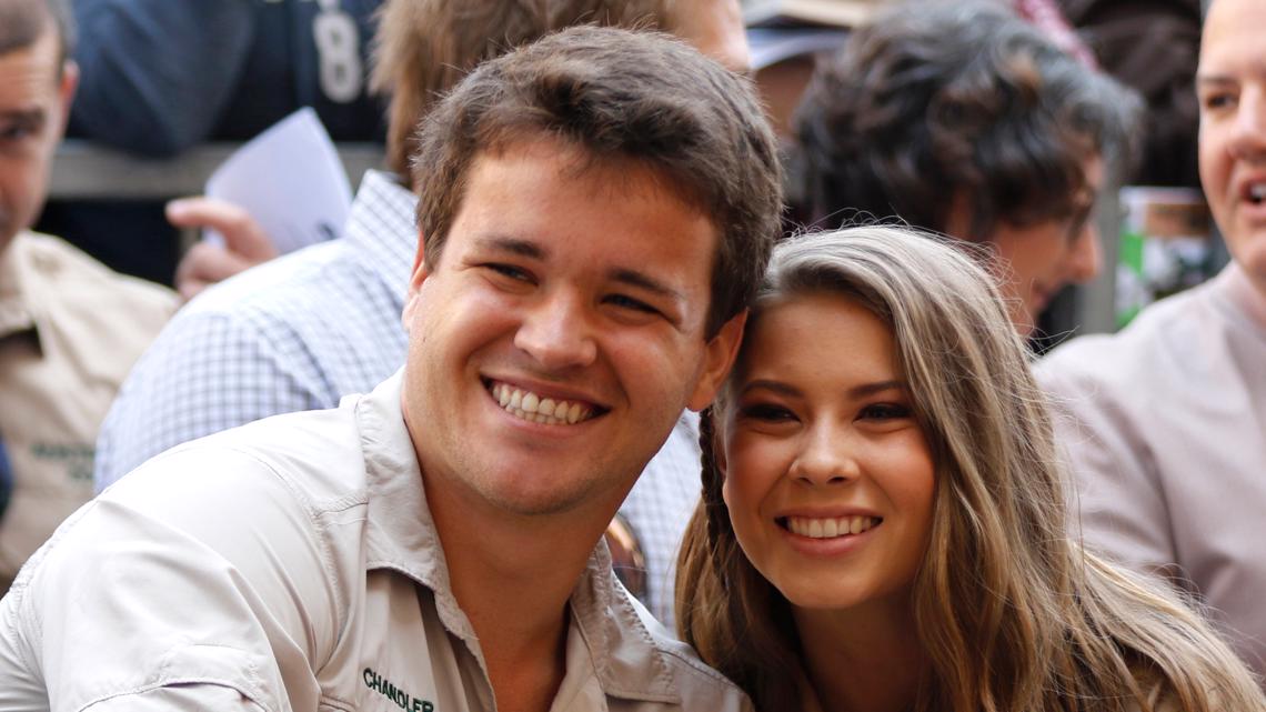 does bindi irwin have mosaic down syndrome