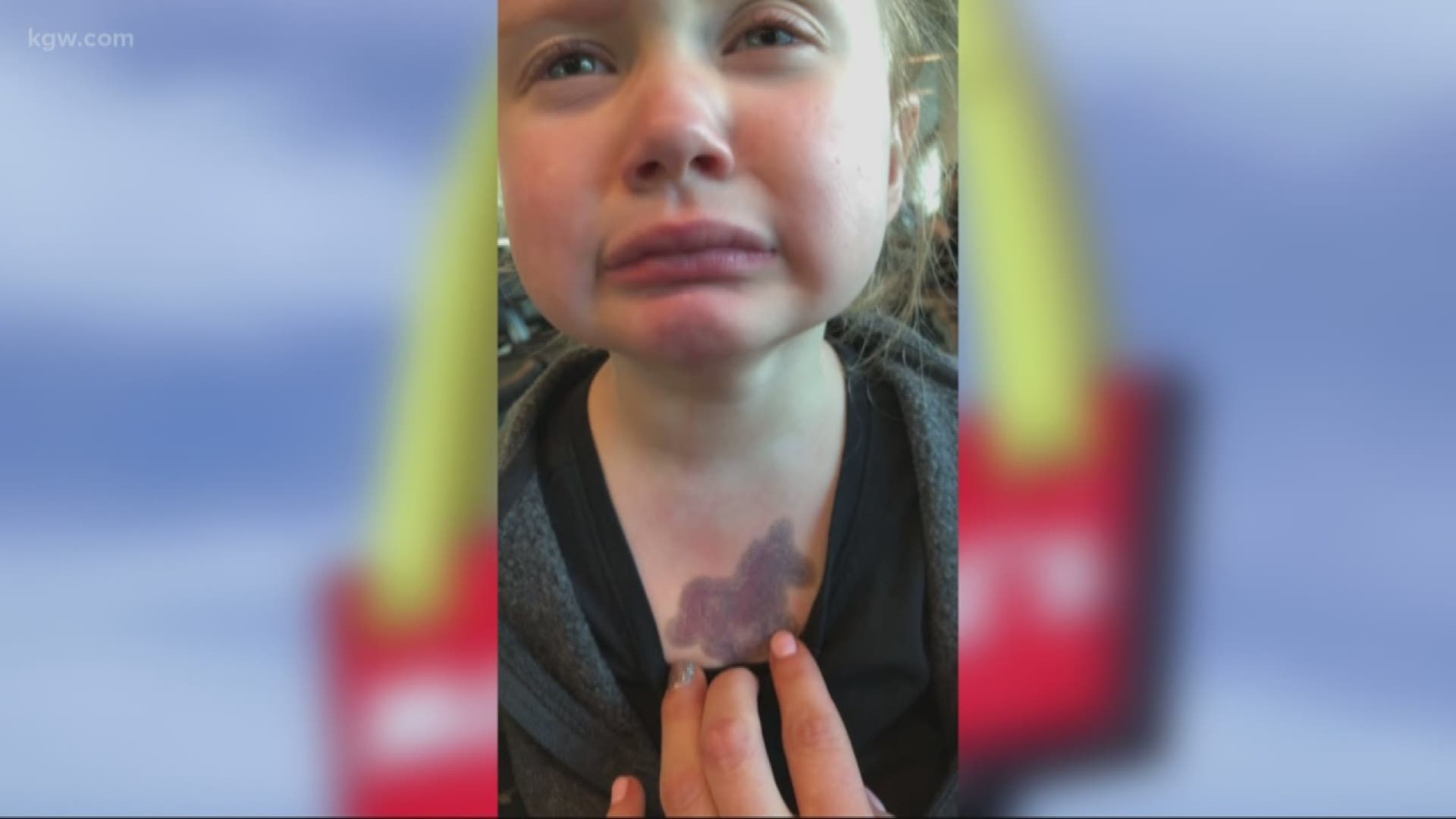 Emily Dolbeer and four-year-old Lainey were at the airport on the way to Disneyland when she tried to take a sip. "It was hotter than I would have drank coffee or tea or anything it was absolutely burning," mother Emily said.