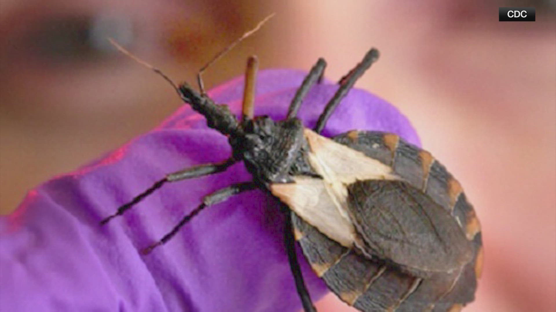 What you need to know about 'kissing bug' disease in Texas