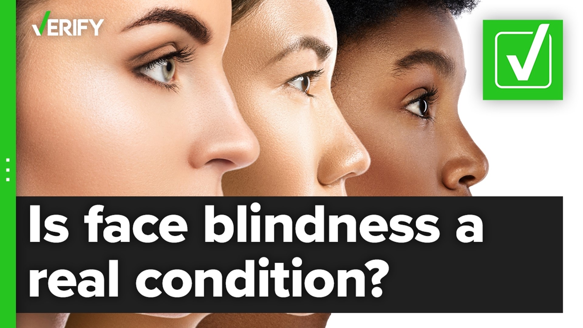Is face blindness a real condition? The VERIFY team confirms this is true.