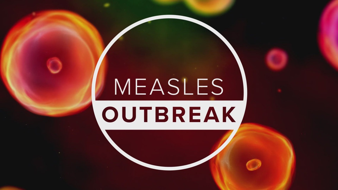Measles case confirmed in Union County