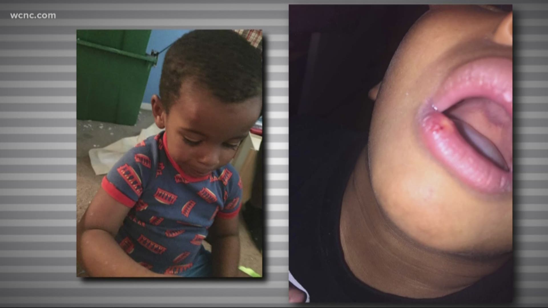 That mother claims someone working inside the school harmed her 4-year-old. Charlotte-Mecklenburg Police are investigating the incident.