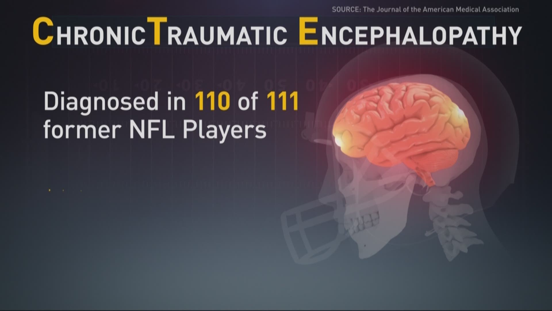 Study into link between former NFL players and brain injury found 110 out  of 111 had CTE