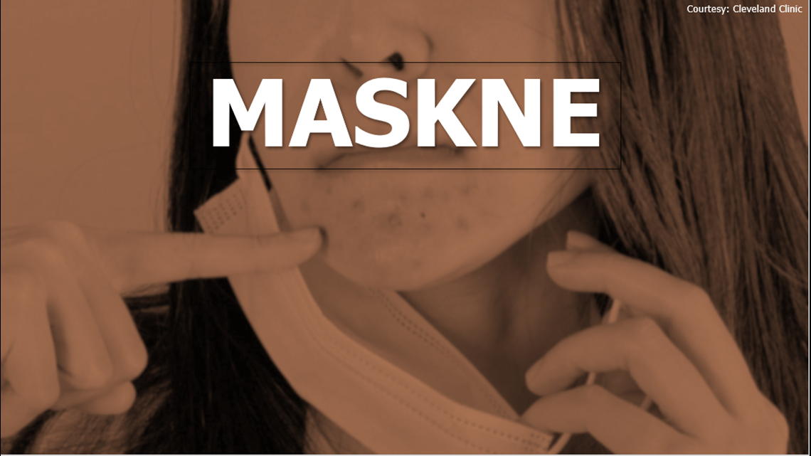 5 tips to keep your skin clear while wearing a face mask all day