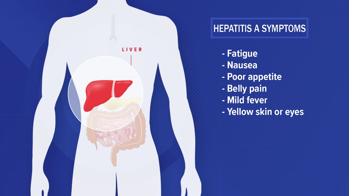 What You Should Know About Hepatitis A And How It Spreads Wcnc