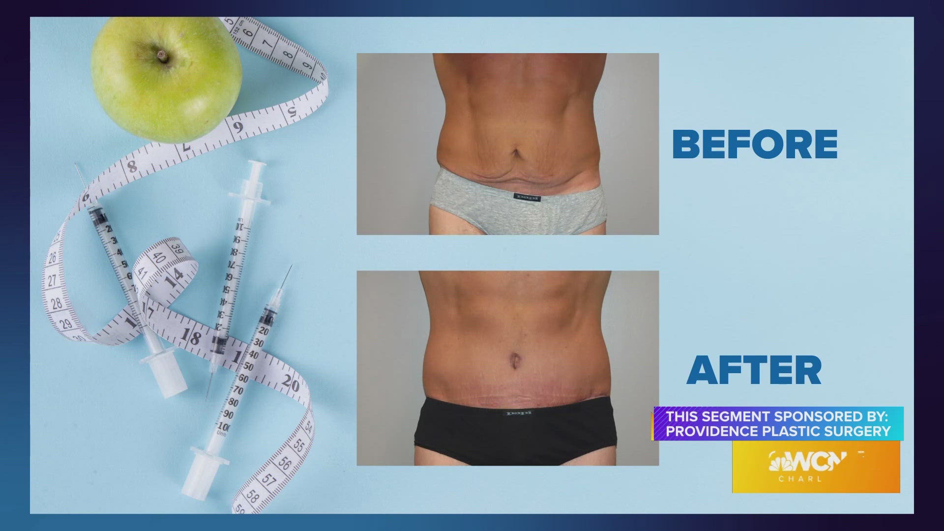 Local doctor says he's seen a surge in these types of procedures after Ozempic weight loss