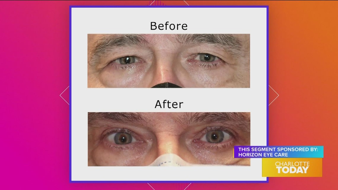 Horizon Eye Care can satisfy your needs!