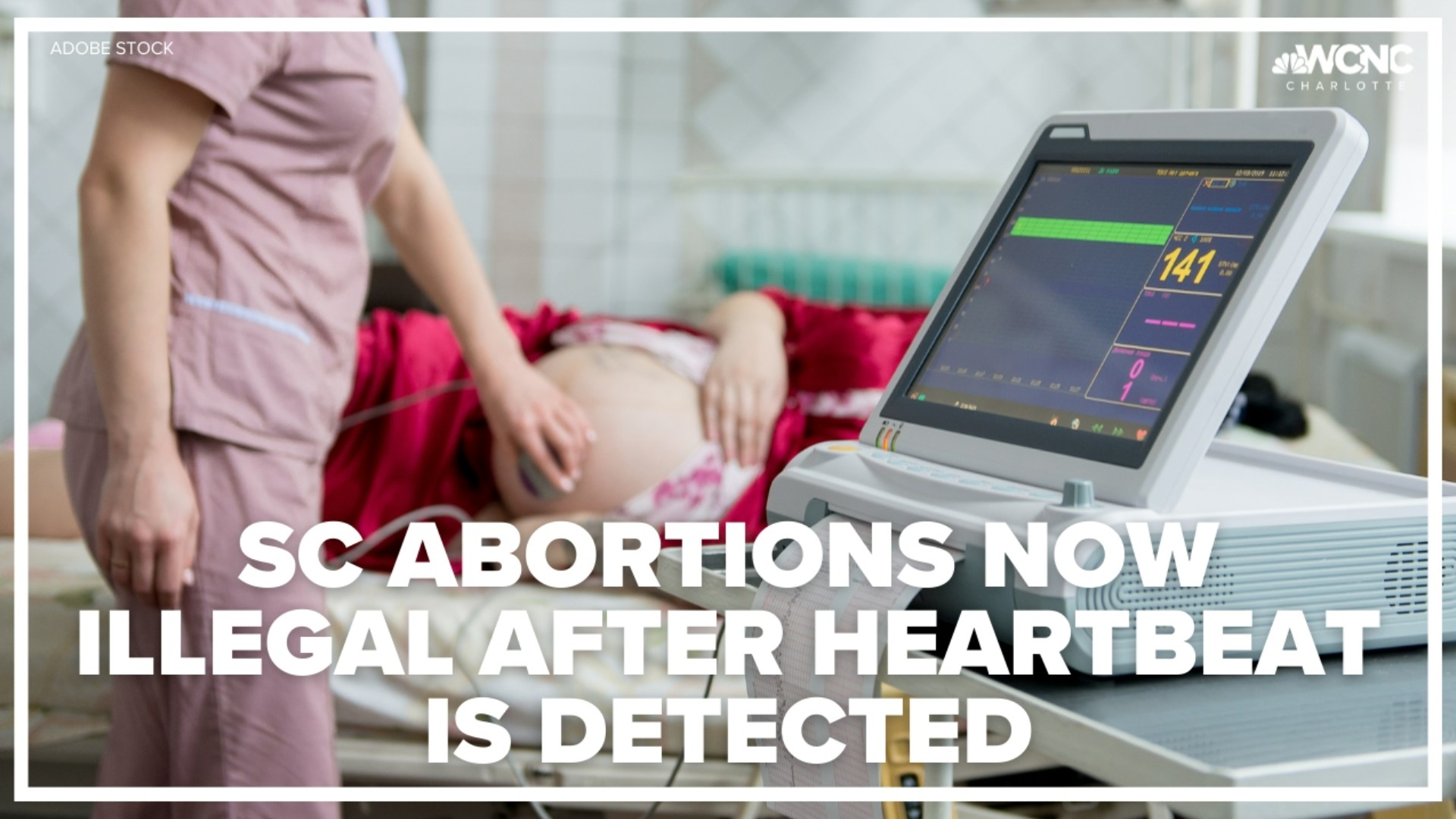 In South Carolina, it’s now illegal to have most abortions after a fetal heartbeat is detected, which is normally around six weeks.
