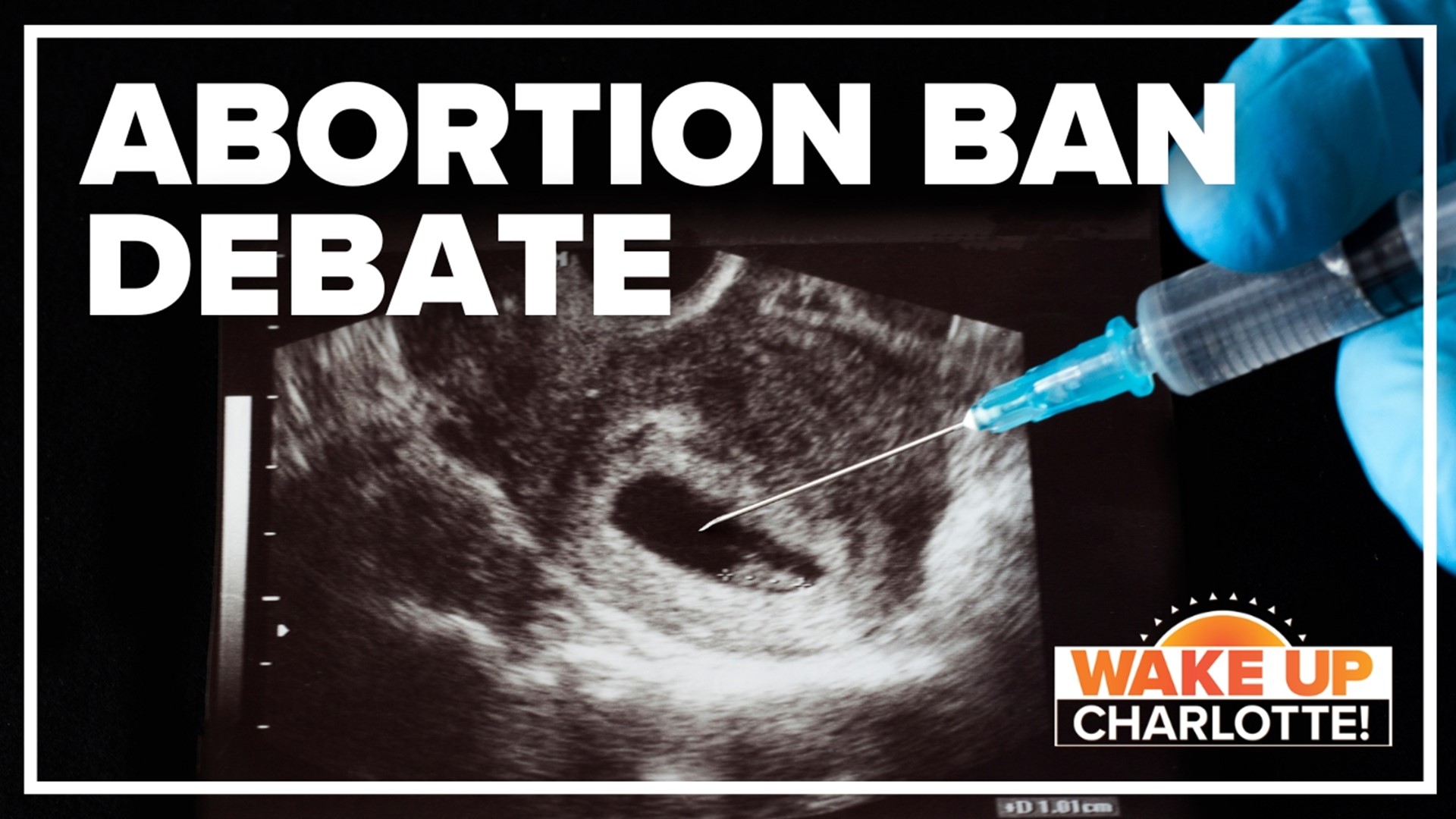 South Carolina continue to debate the abortion bill today.