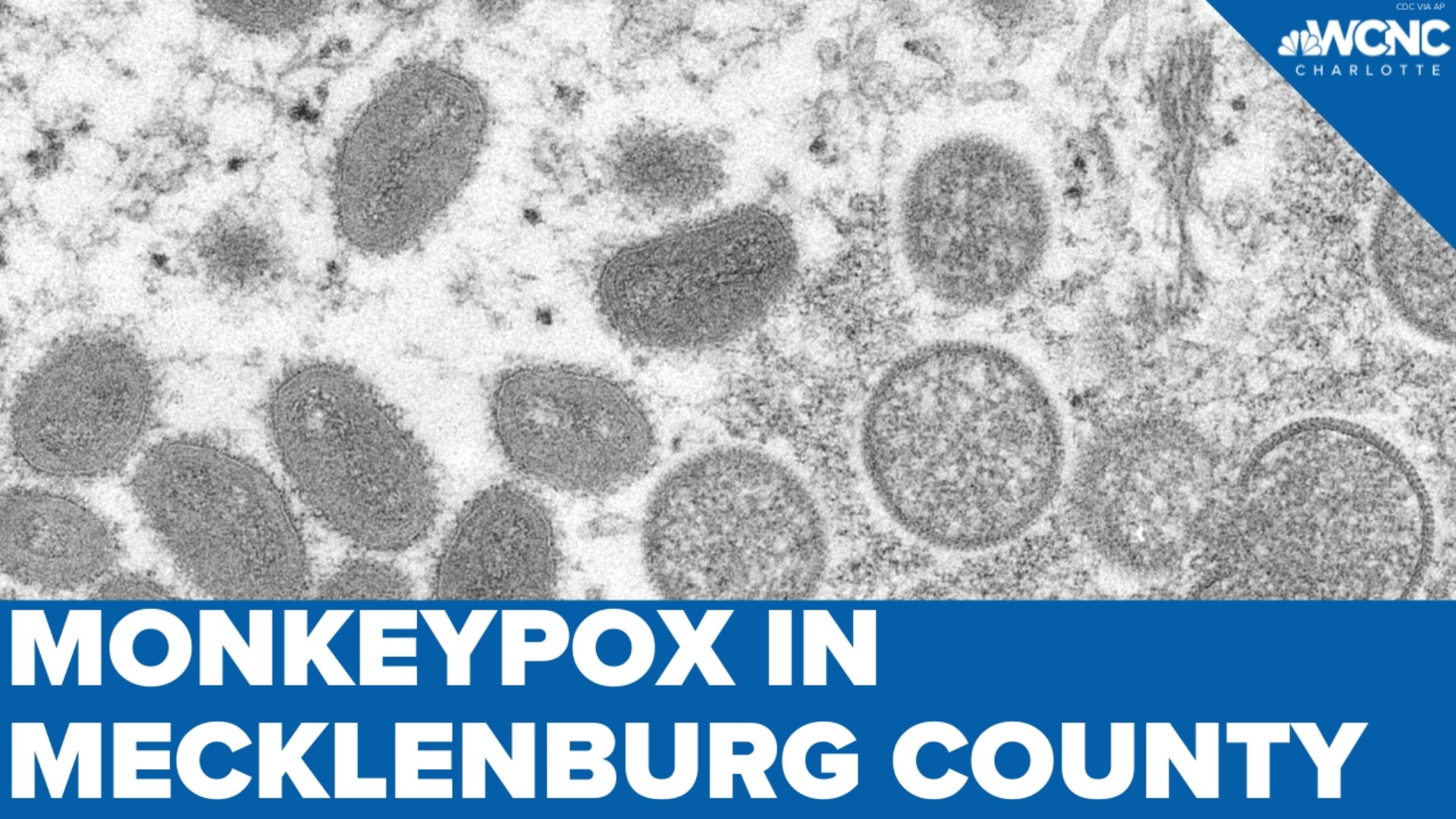Mecklenburg County Public Health confirms it's first case of Monkeypox. This is the second confirmed case in North Carolina.