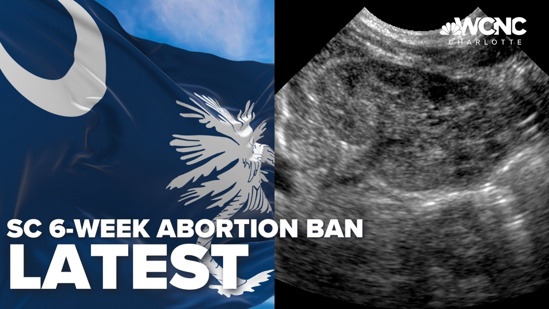 If it becomes law, it would ban most abortions after six weeks.