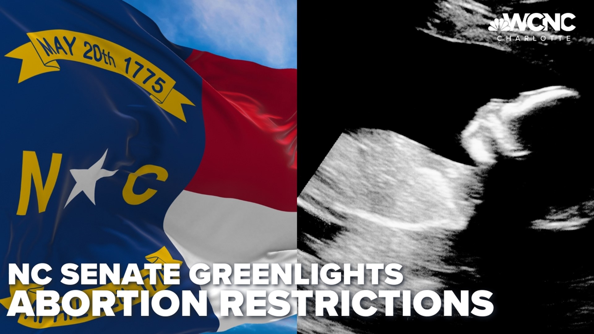 A 12-week abortion ban is one step closer to becoming a reality in North Carolina.