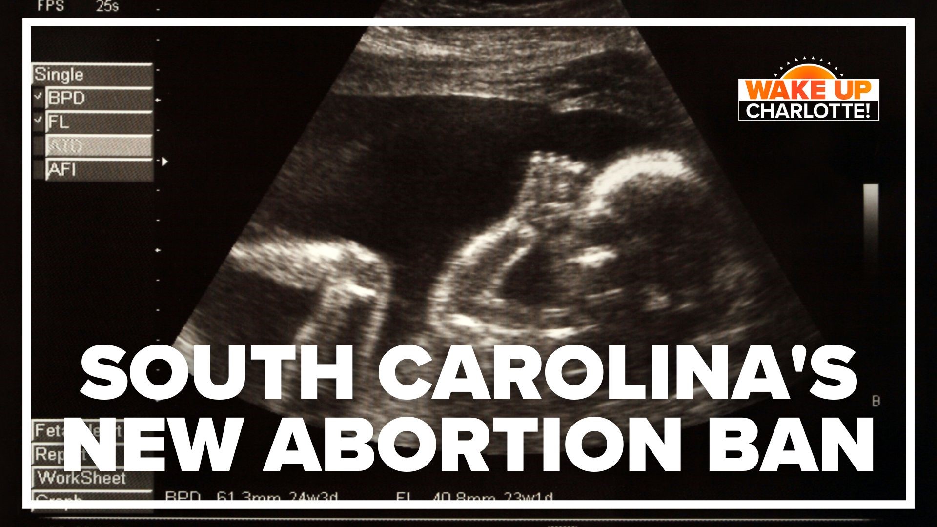 South Carolina Senate passes new six week abortion ban