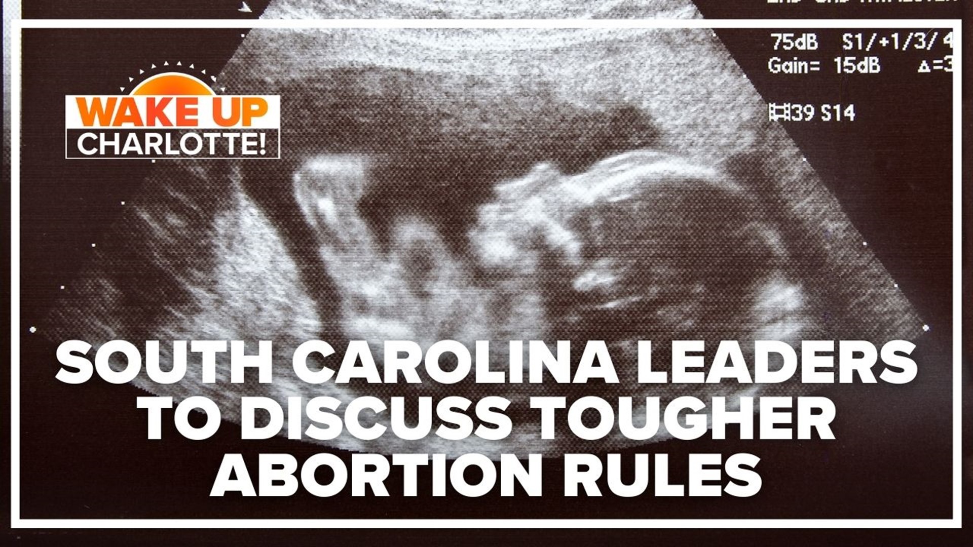 One day after North Carolina Gov. Roy Cooper acted to protect abortion rights, South Carolina leaders will meet to discuss tougher laws against the procedure.