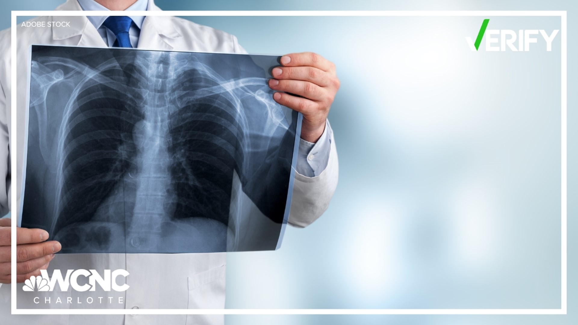 It might sound concerning, but doctors say there is some good news. Lung cancer cases overall are declining.