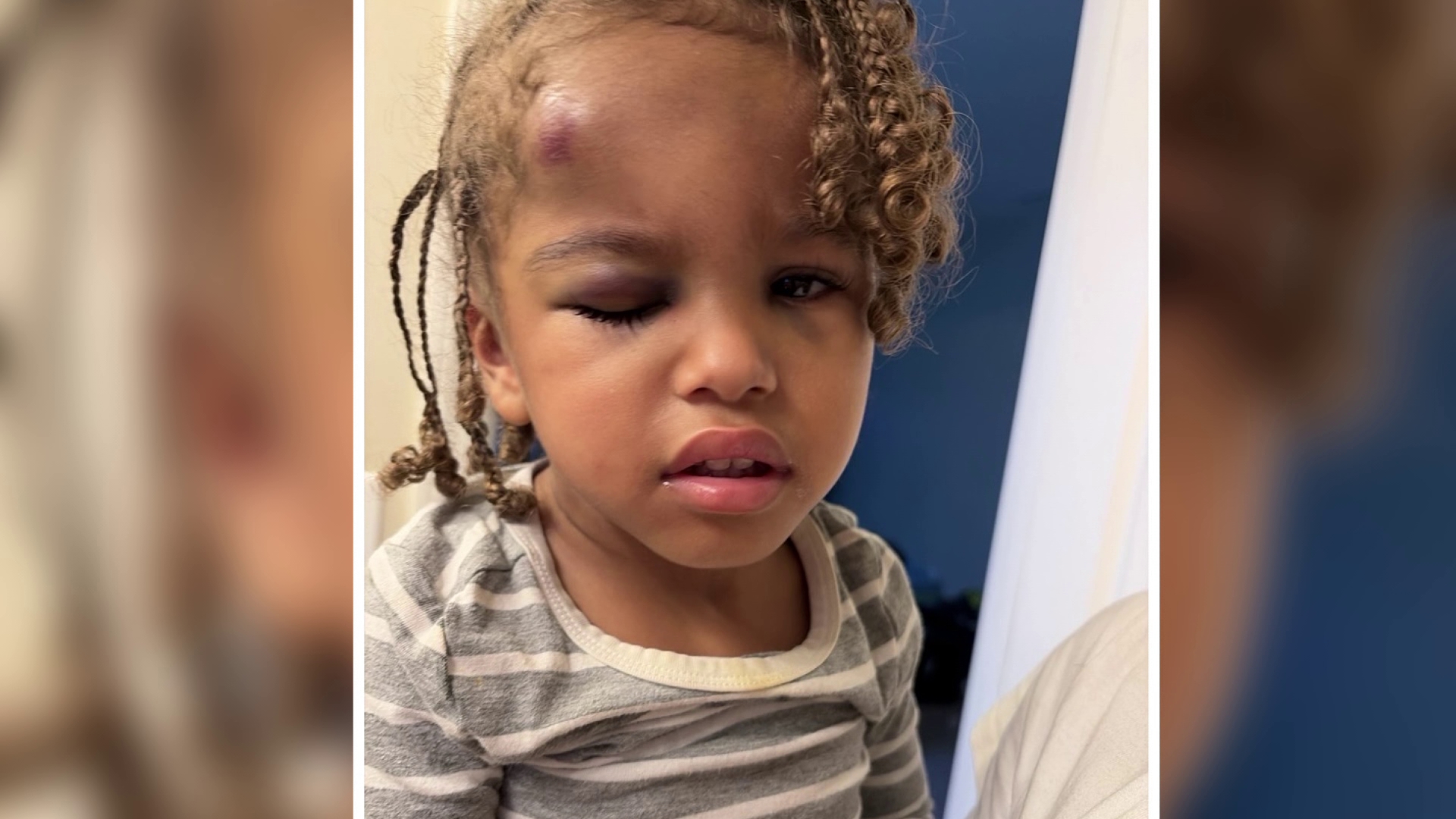 Mom demands answers after 3-year-old injured at Concord daycare