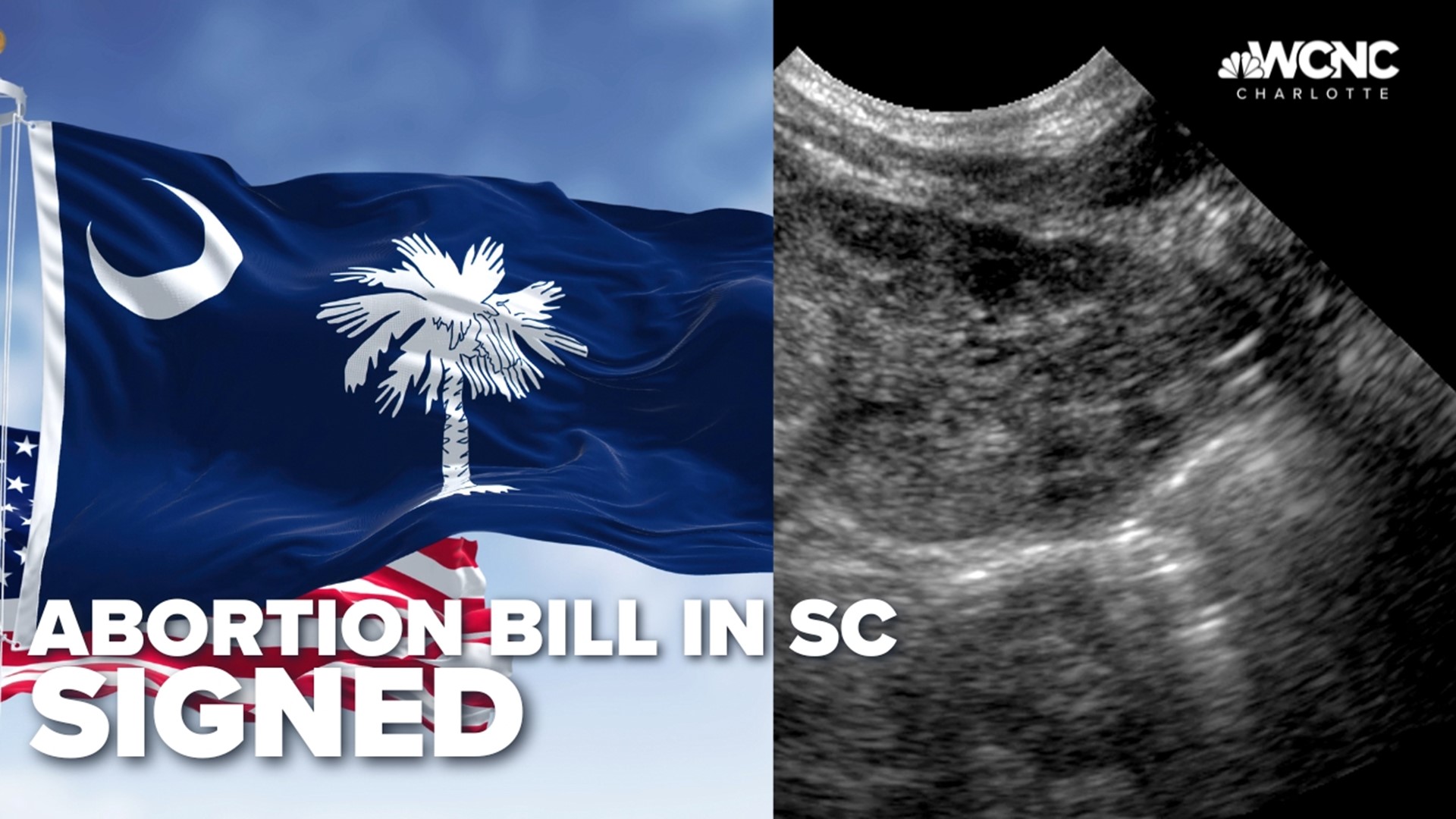 A six-week abortion ban is now in effect in South Carolina.