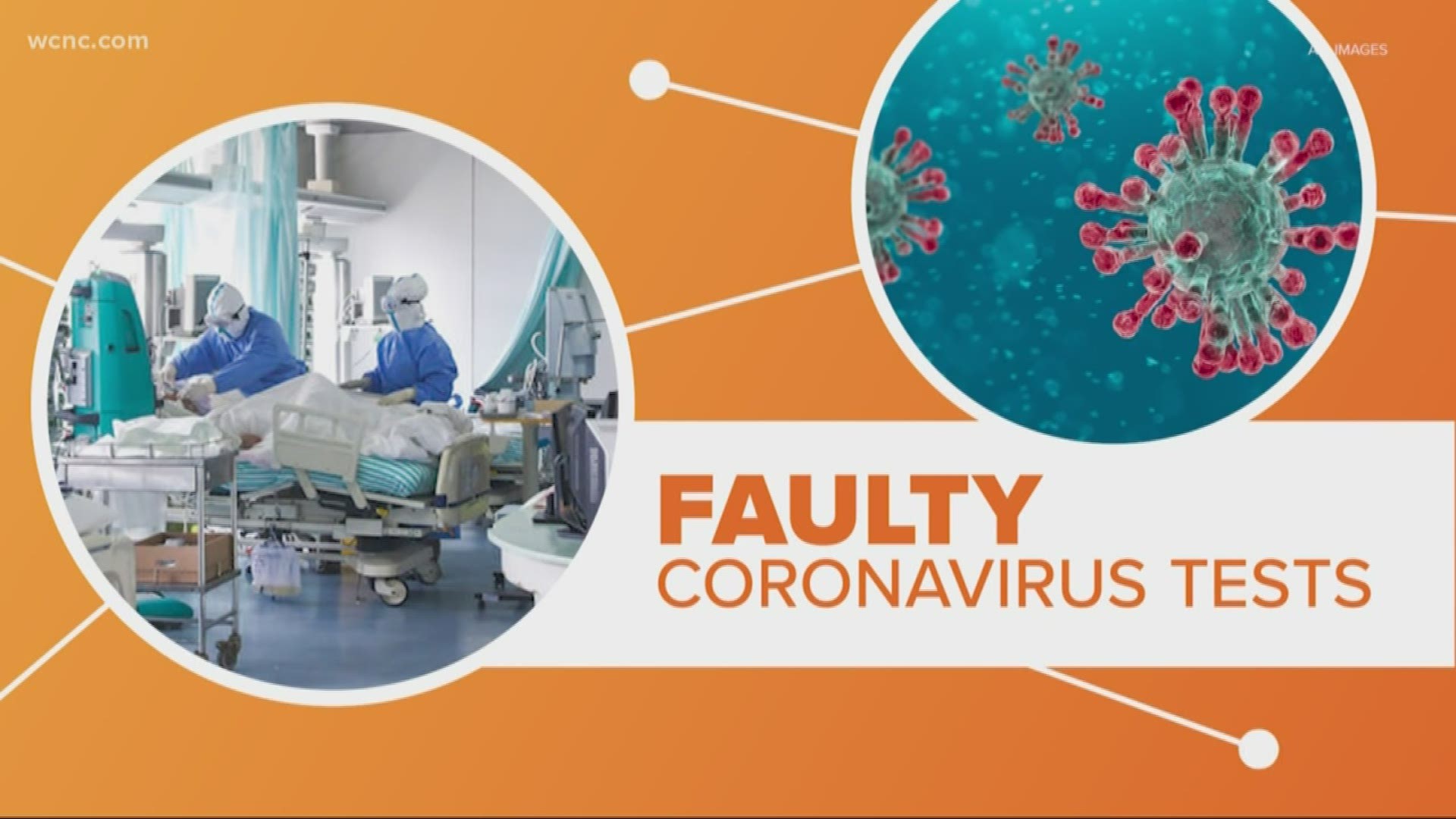 Health officials say Americans should prepare for the spread of the coronavius in the U.S. Containing the virus could be harder because of a hiccup by the CDC.
