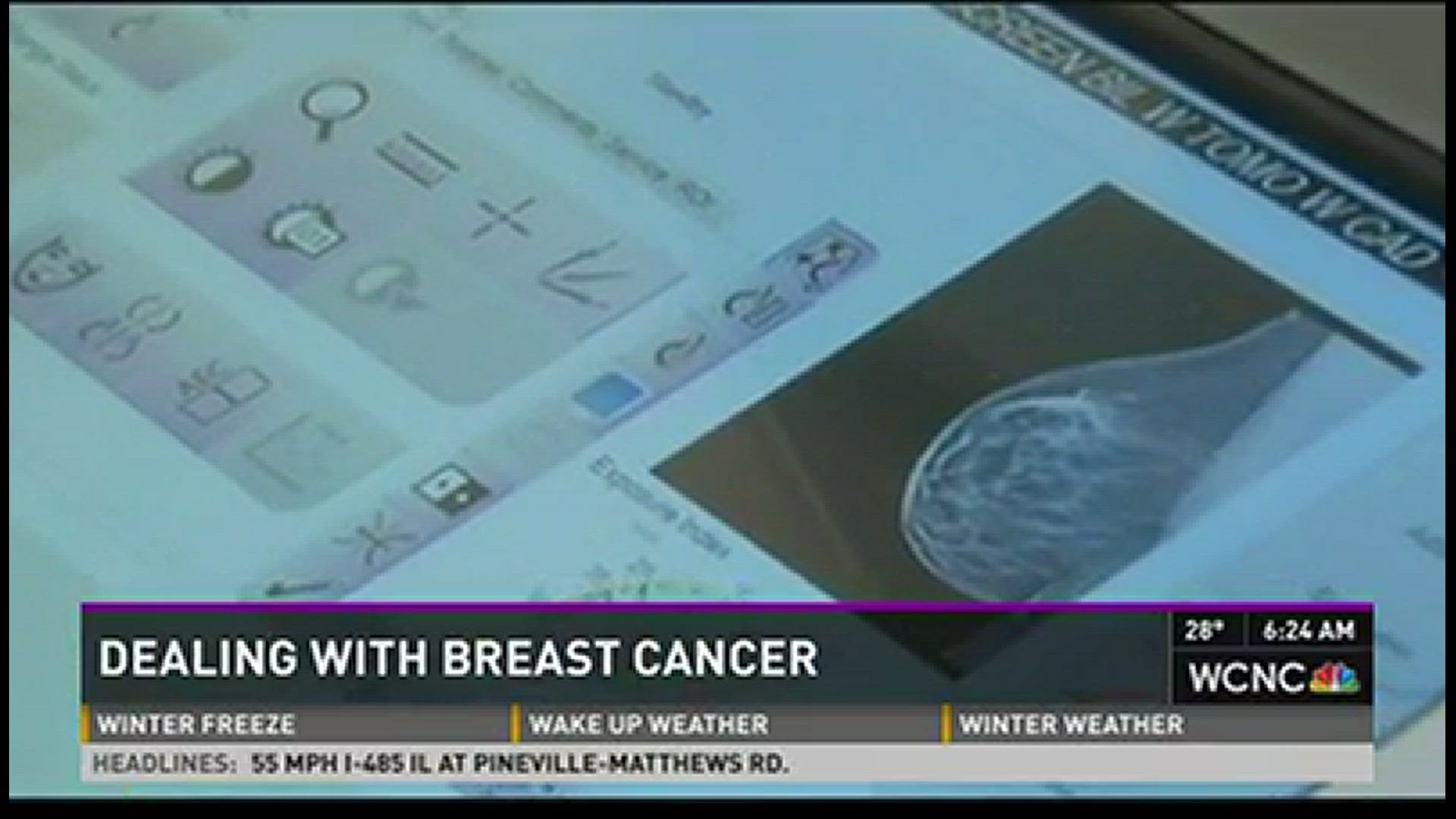 What happens when you find out you have breast cancer?