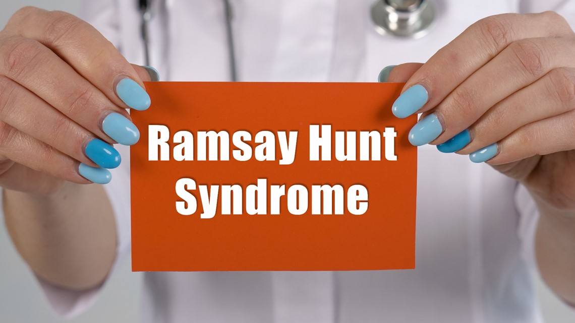 What Is Ramsay Hunt Syndrome Wcnc what-is-ramsay-hunt-syndrome-wcnc