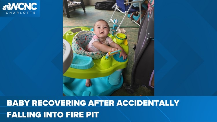 Baby girl falls into fire pit, suffers 2nd-degree burns