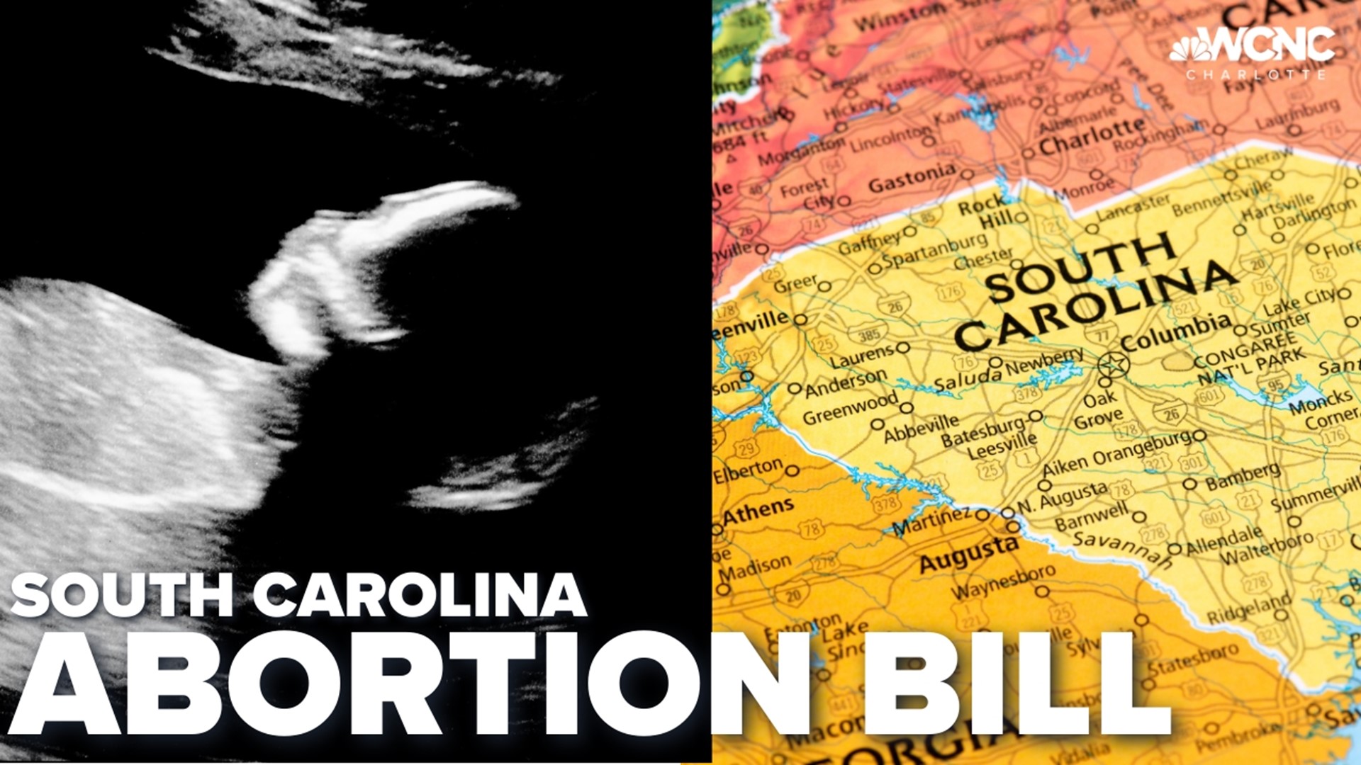 A new bill in the state legislature would ban abortions and criminalize it as a homicide.