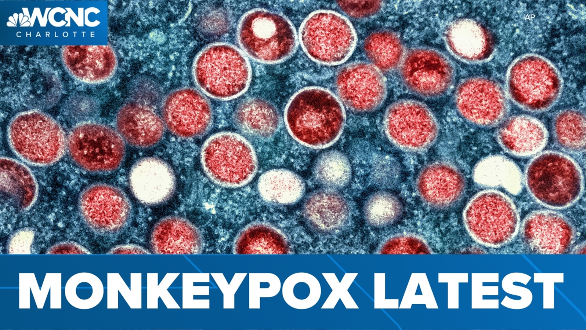 The U.S. is now declaring Monkeypox a public health emergency as more cases are being reported across the country.