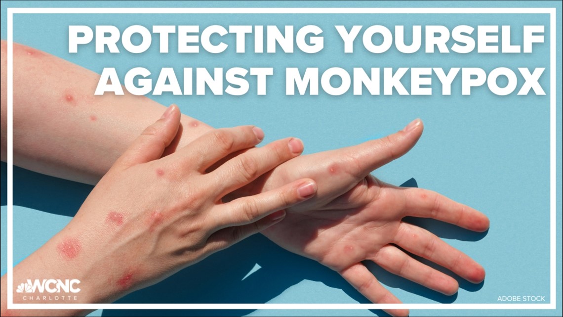 Protecting yourself against monkeypox