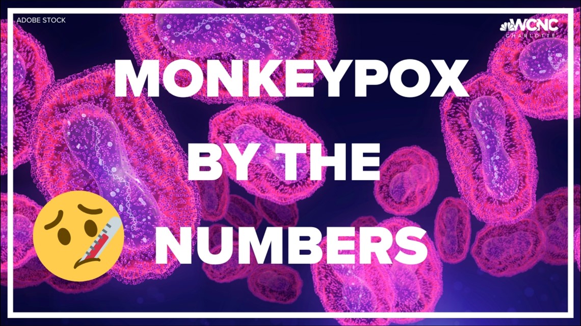Most of North Carolina's monkeypox cases are in Mecklenburg County