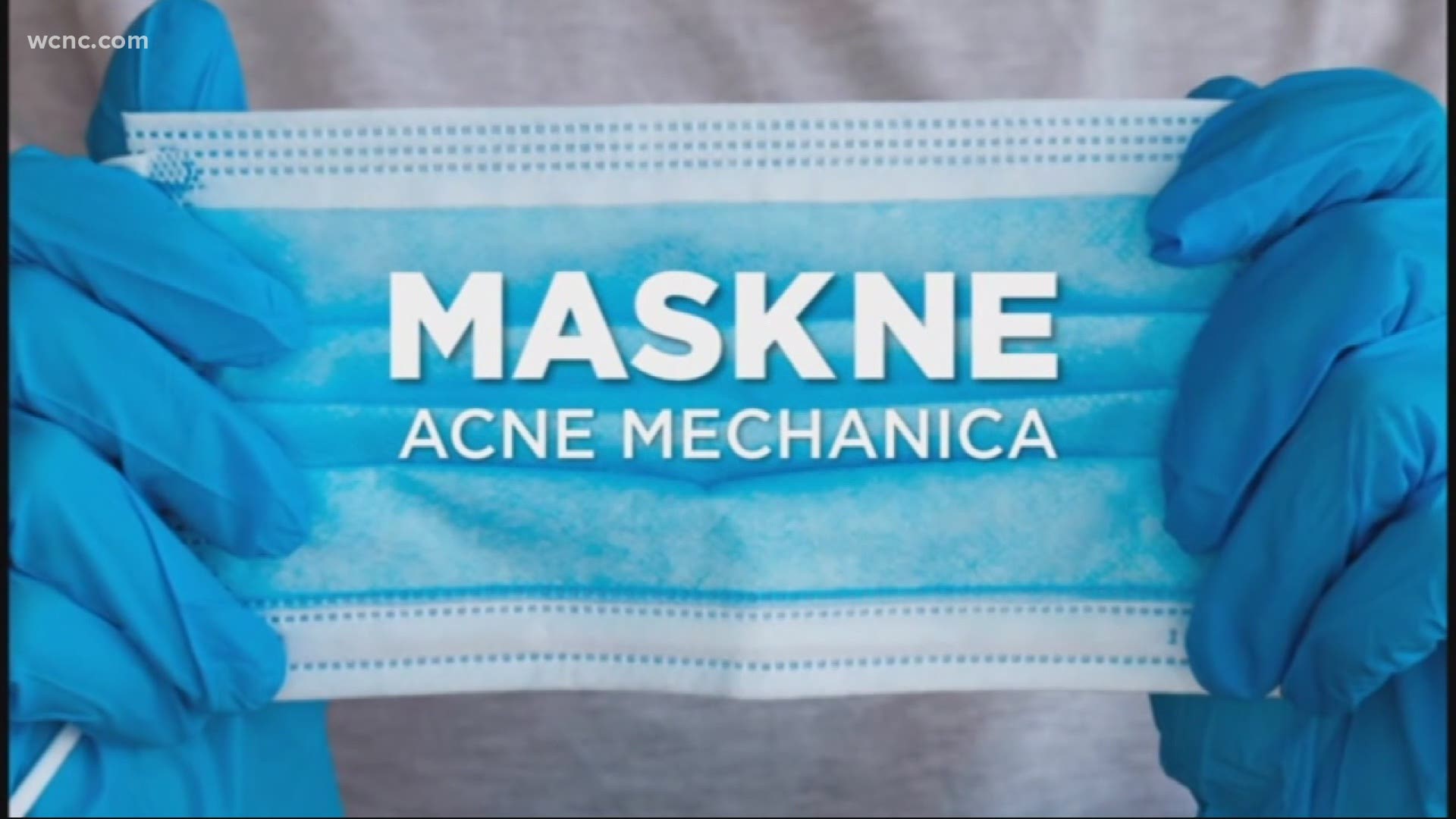 Acne is something many teens and adults have to deal with, and now that they're wearing masks all the time, a new issue is rising up: It's called "maskne."