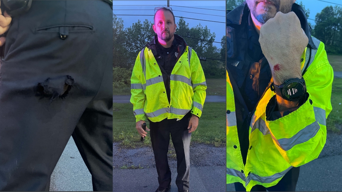 PHOTOS: LMPD officer's injuries after Scottie Scheffler arrest - Vimarsana News