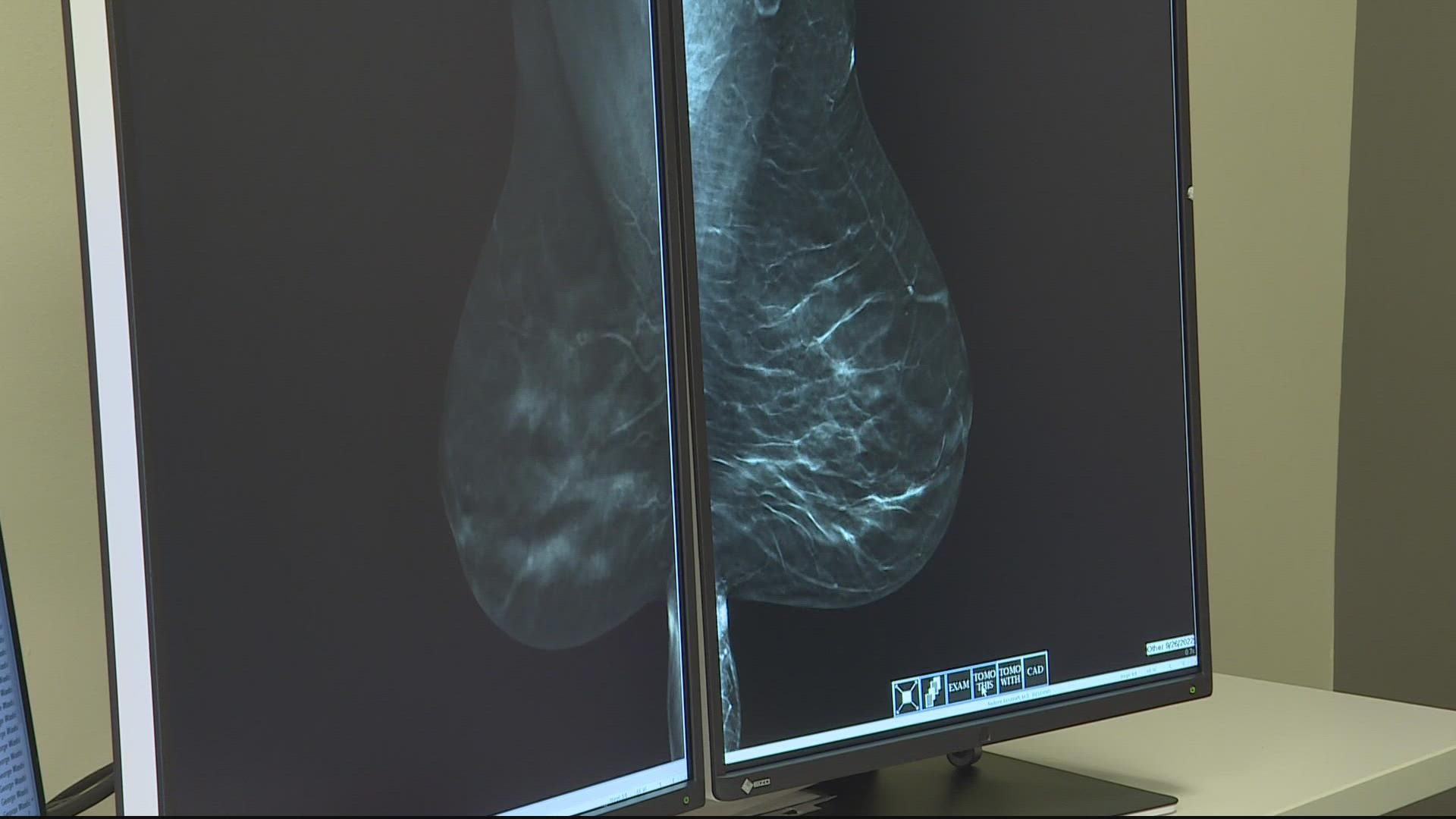 In the next six weeks, George Washington Cancer Center is adding artificial intelligence to breast cancer screening. This tool could help detect cancer.