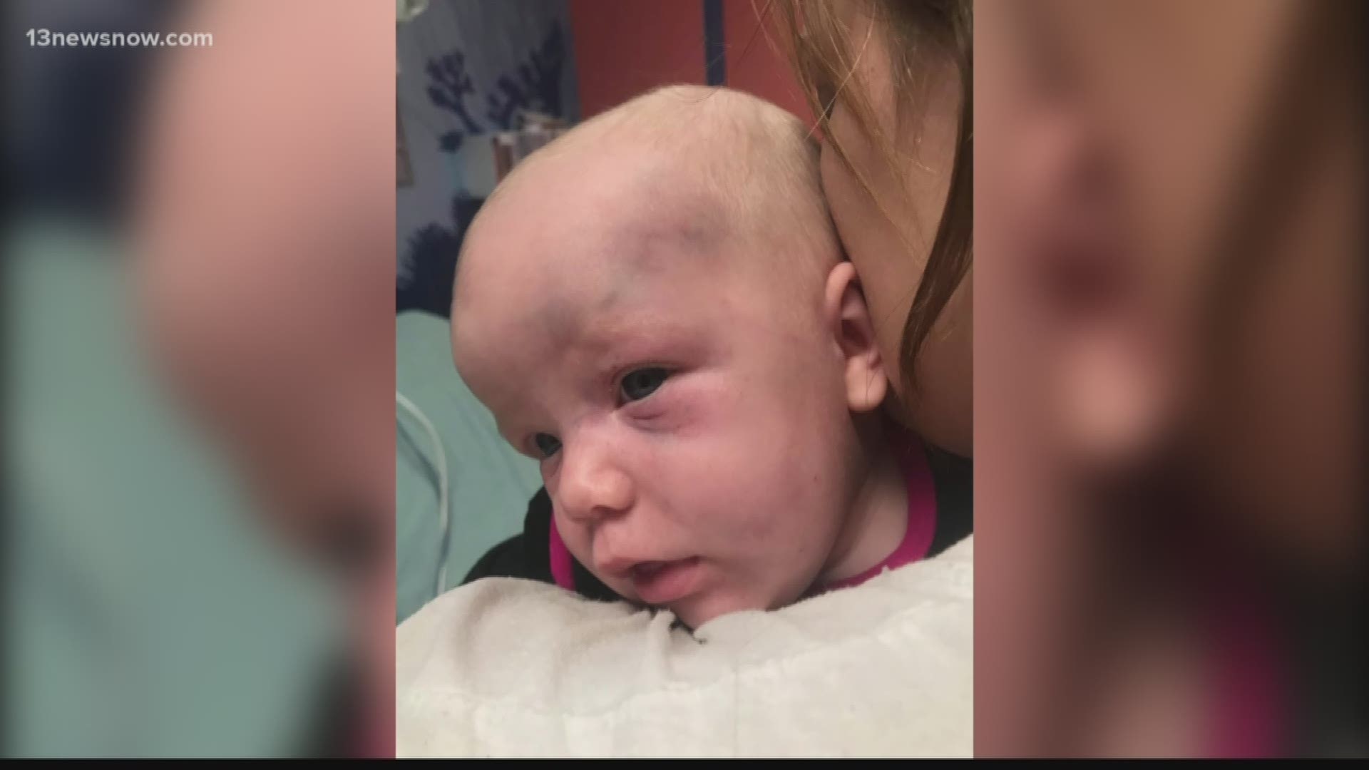 A baby was bruised and taken to a local hospital after their sitter hit a baby Harper