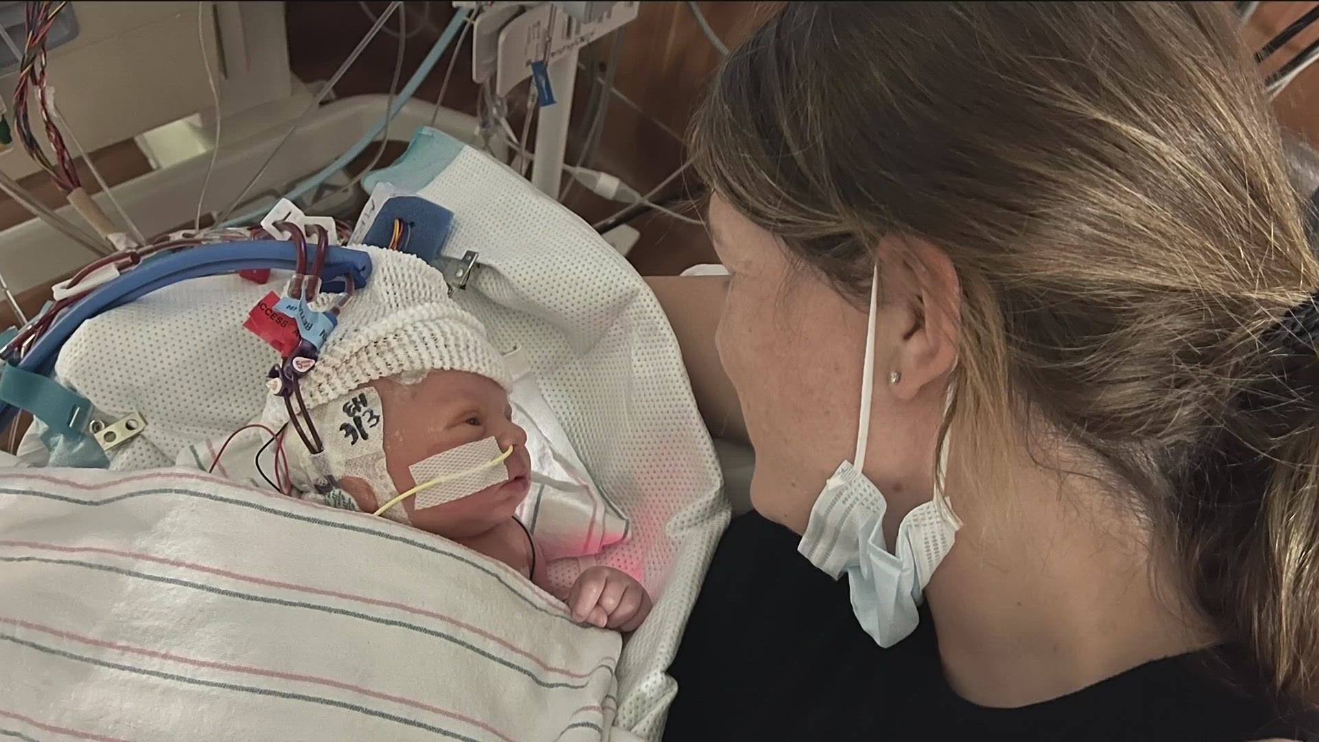 An Atlanta family shared their story about their baby's rare genetic disorder.