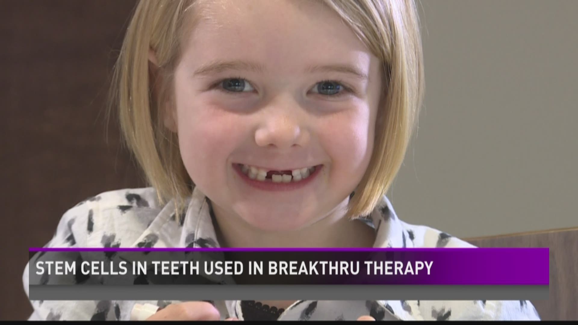 Stem cells in teeth used in breakthrough therapy